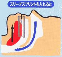 スリープスプリント