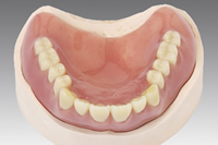 レジン義歯